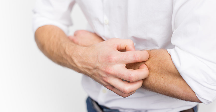 This Essential Nutrient Helps Heal Eczema, Psoriasis and Dry Skin