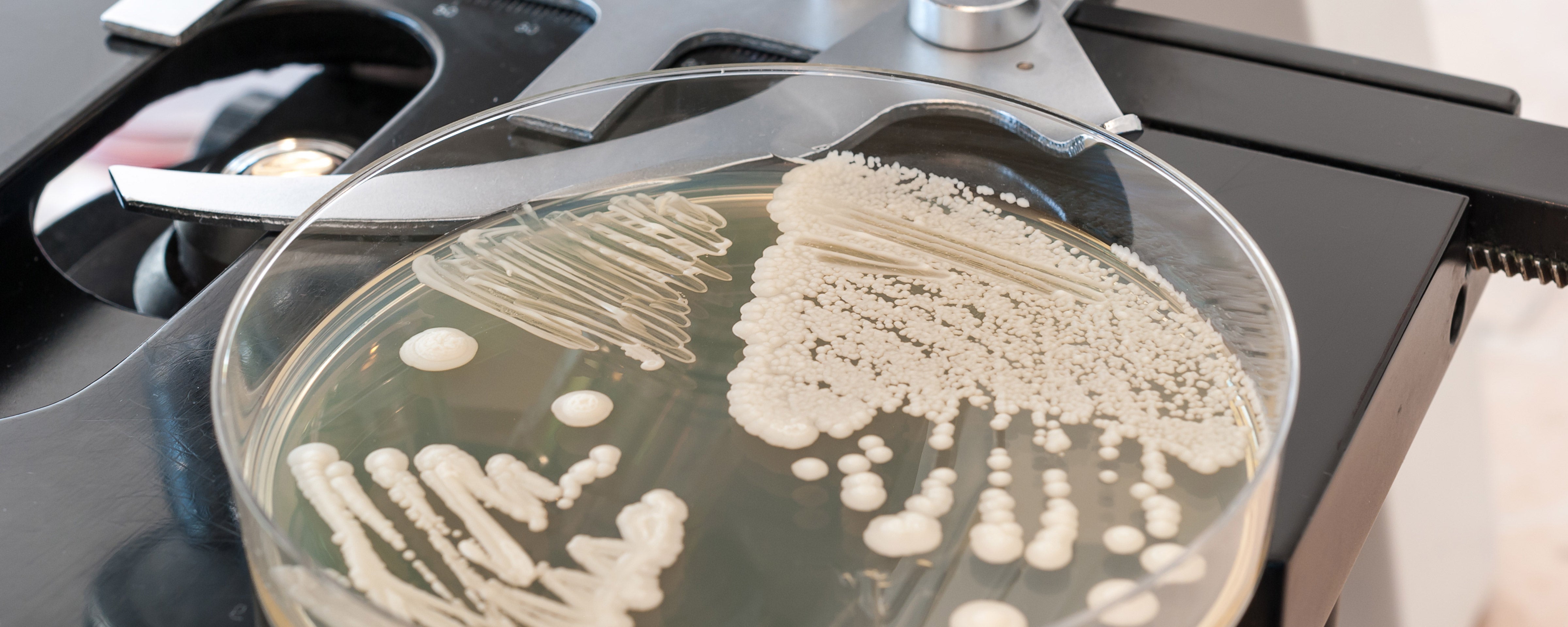 candida auris