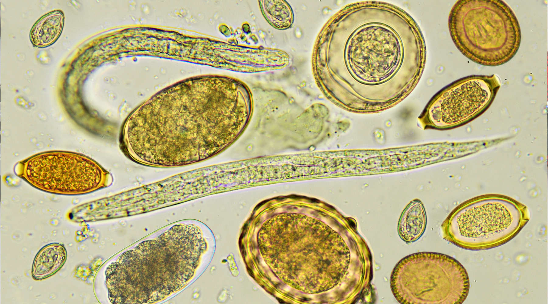 Parasite Cleanse: What It Is, Signs to Watch For, and How to Do It Safely