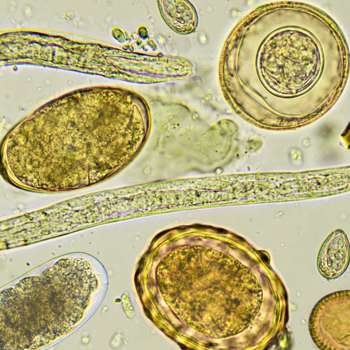 Parasite Cleanse: What It Is, Signs to Watch For, and How to Do It Safely