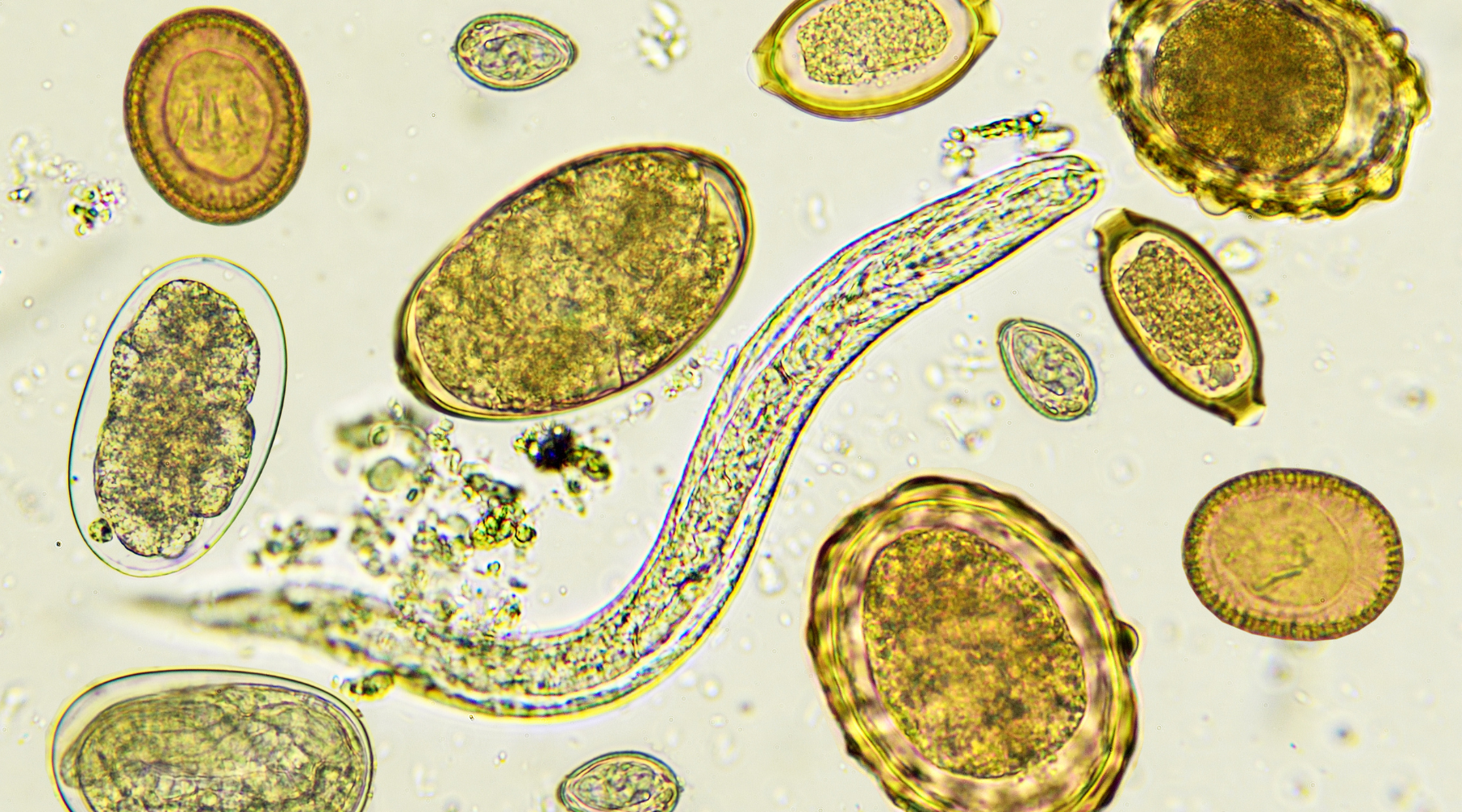 The Parasite Problem You Didn’t Know You Had