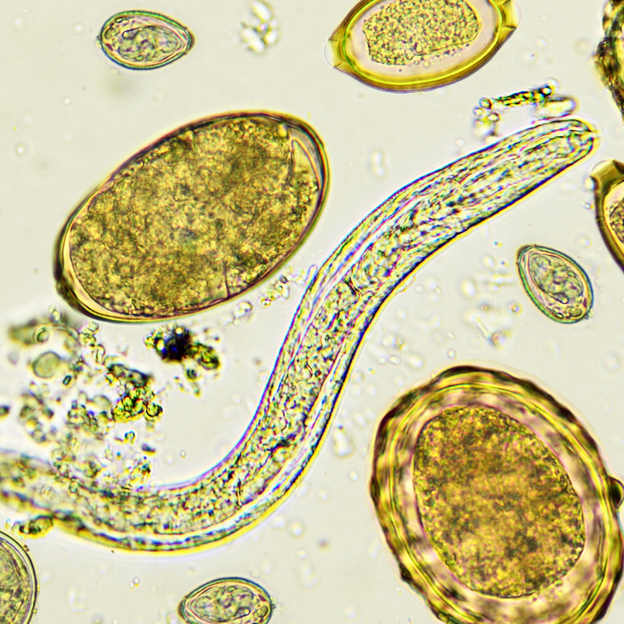 The Parasite Problem You Didn’t Know You Had
