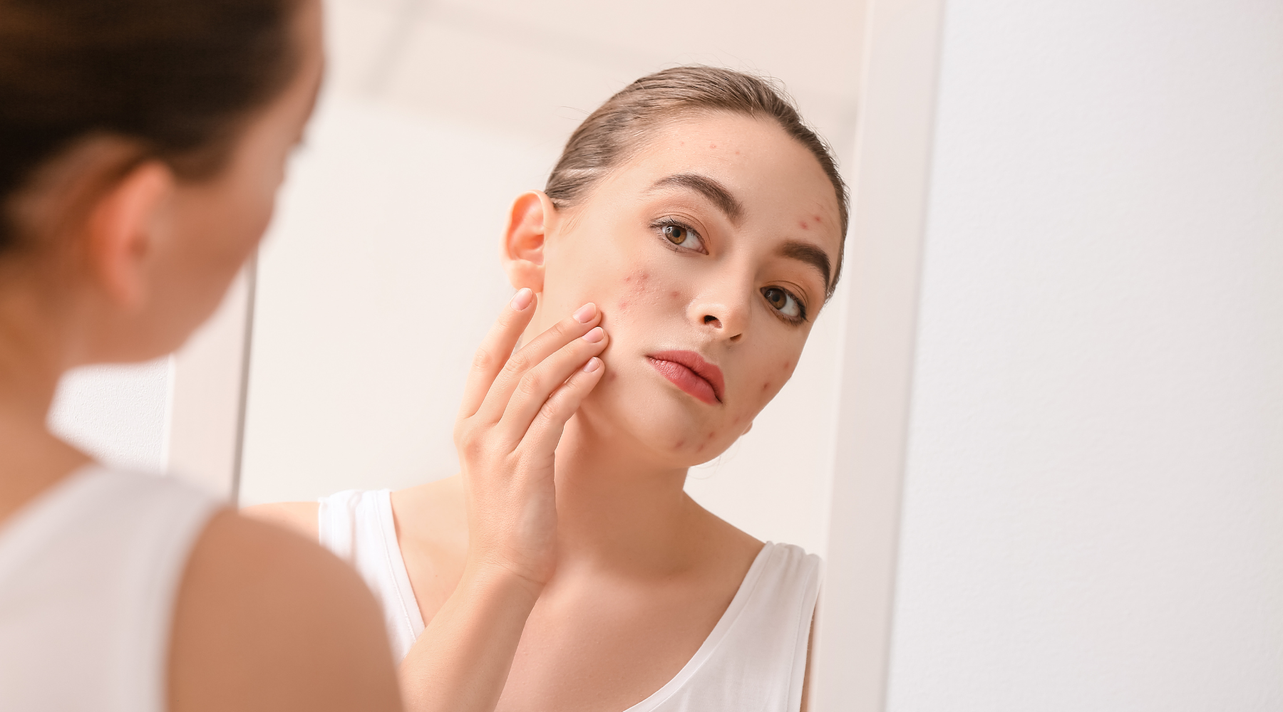 Mirror, Mirror on the Wall… What’s My Skin Trying to Tell Me?
