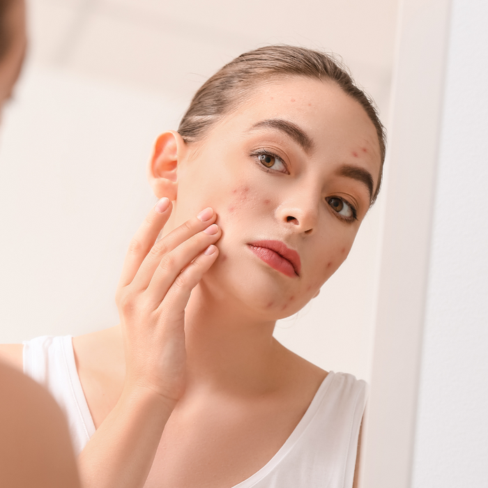 Mirror, Mirror on the Wall… What’s My Skin Trying to Tell Me?