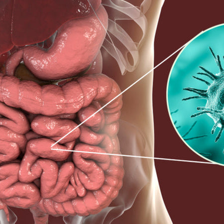 29 Signs of Parasites and What to Do About It