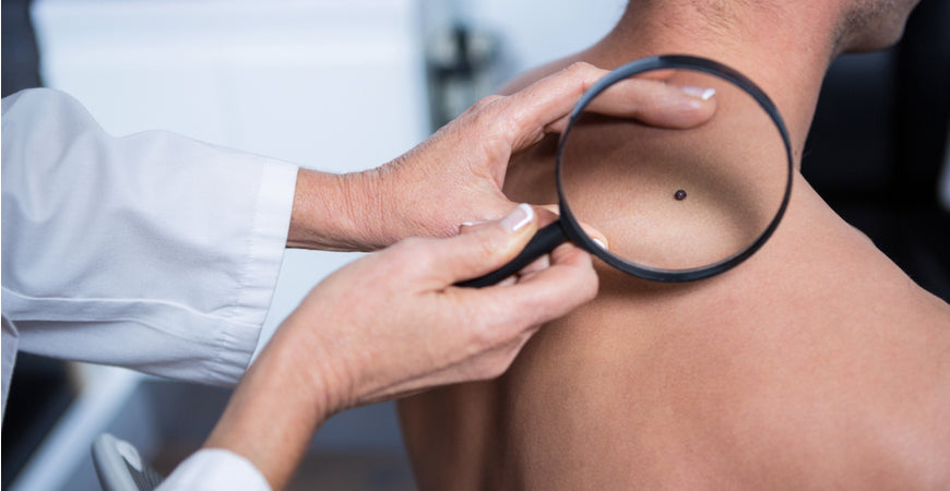 5 Ridiculously Easy Ways to Reduce Your Cancer Risk